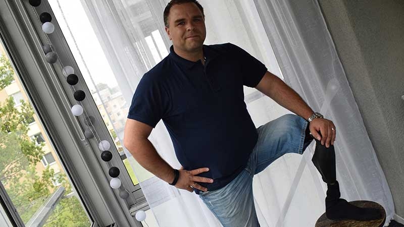 Tomas Stenbäck visar upp sin protes